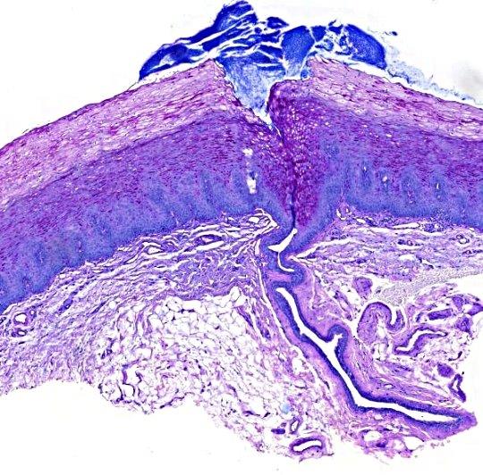 leuconic_p0